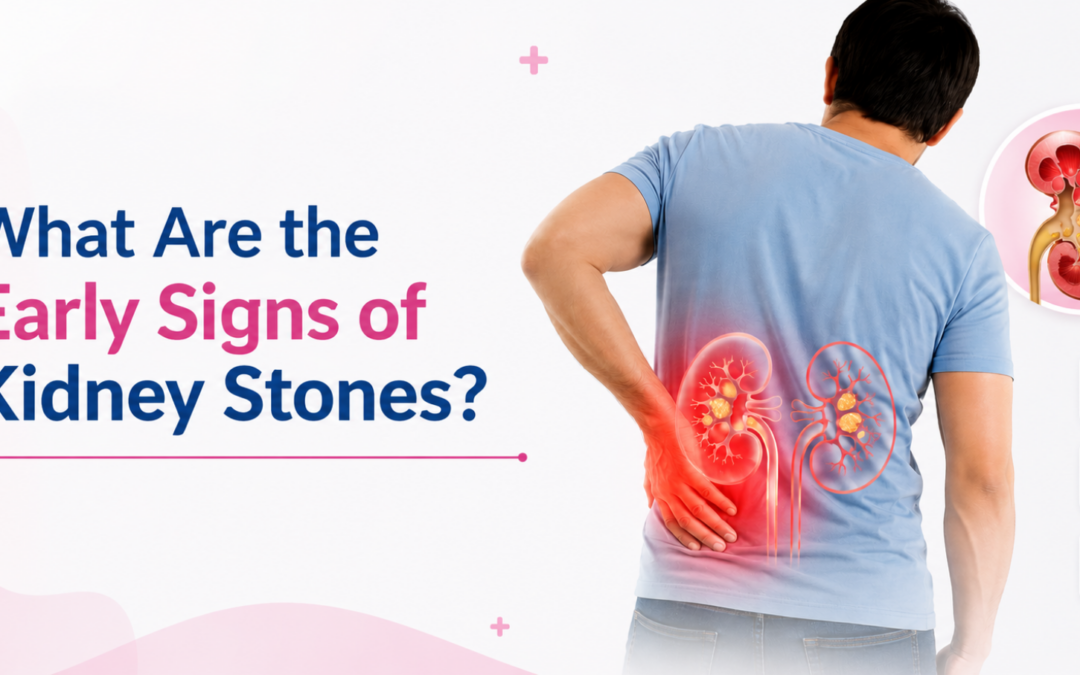 Kidney stones