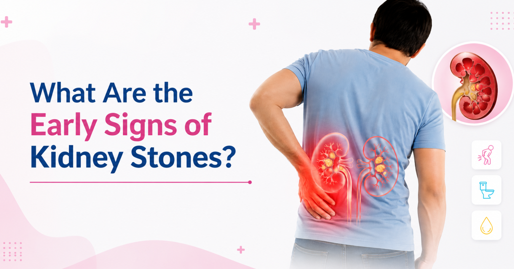Kidney stones